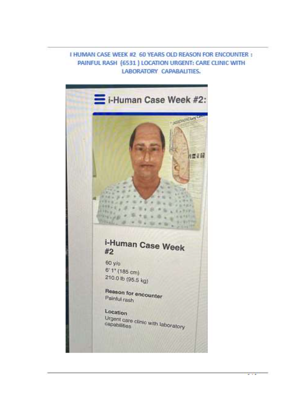Herpes Zoster Case Study: Diagnosing & Managing Shingles in a 60-Year-Old | i-Human Simulation
