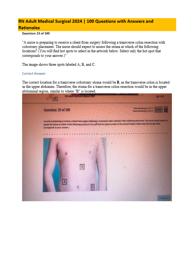 RN Adult Medical-Surgical Exam 2024 – 100 Questions, Answers & Detailed Rationales